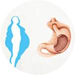 Ghurcıa Obezıtatıı