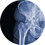 Totul despre Ortopedıe