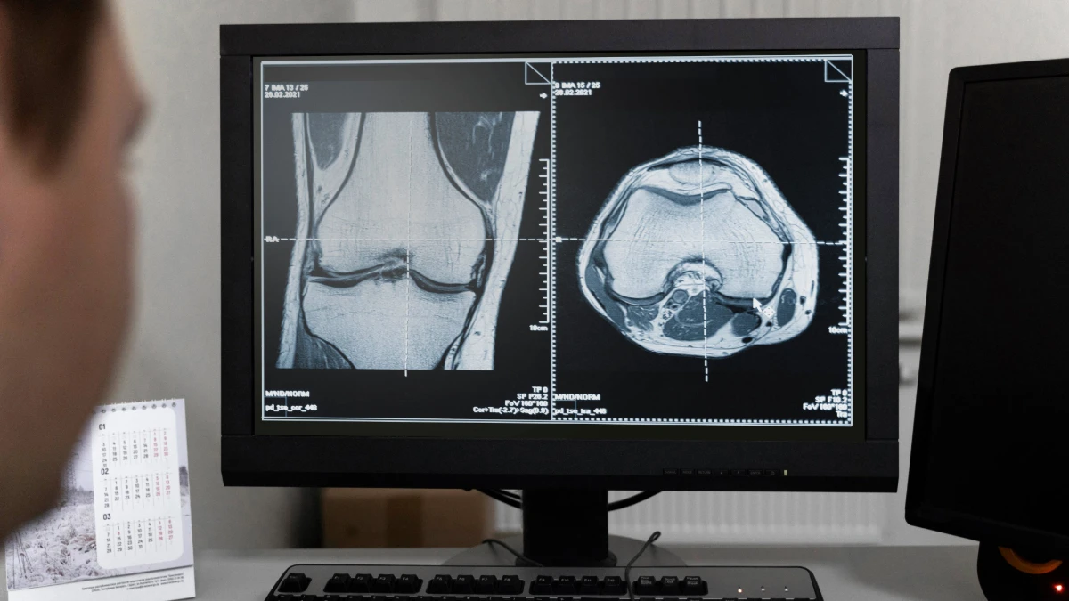 Scanarea densității osoase în Turcia