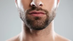 Transplant de barbă în Turcia