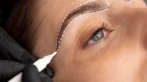 Transplant de sprâncene în Turcia