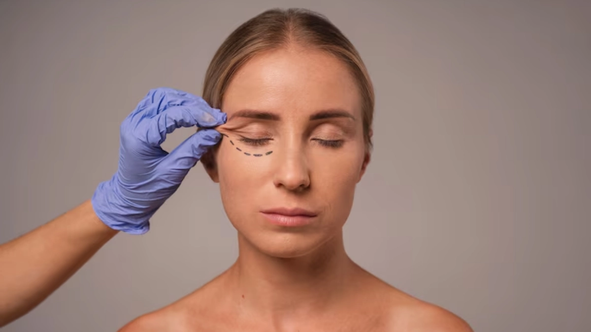 راهنمای جراحی زیبایی پلک در ۵ گام برای چهره‌ای بی‌نقص