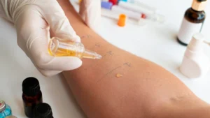 Allergy Testing in Turkey