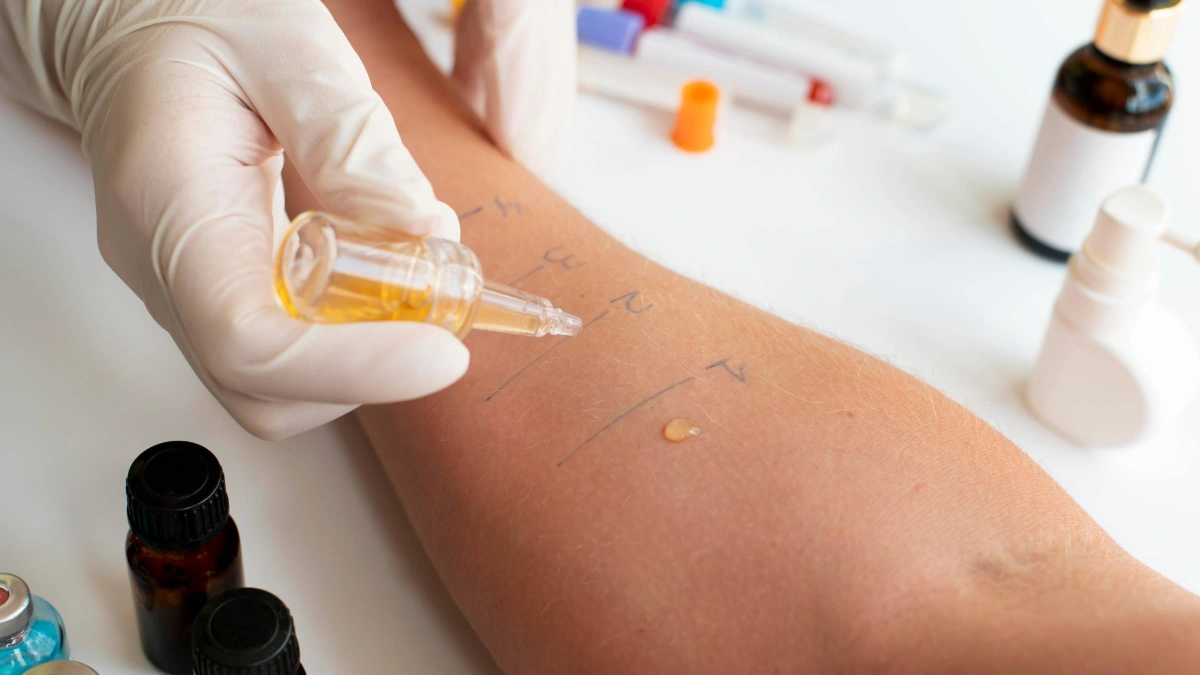 Allergy Testing in Turkey