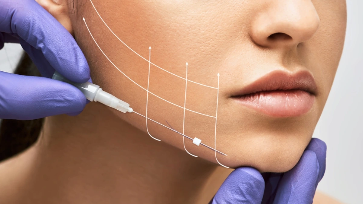 Повдигане на конец в Турция