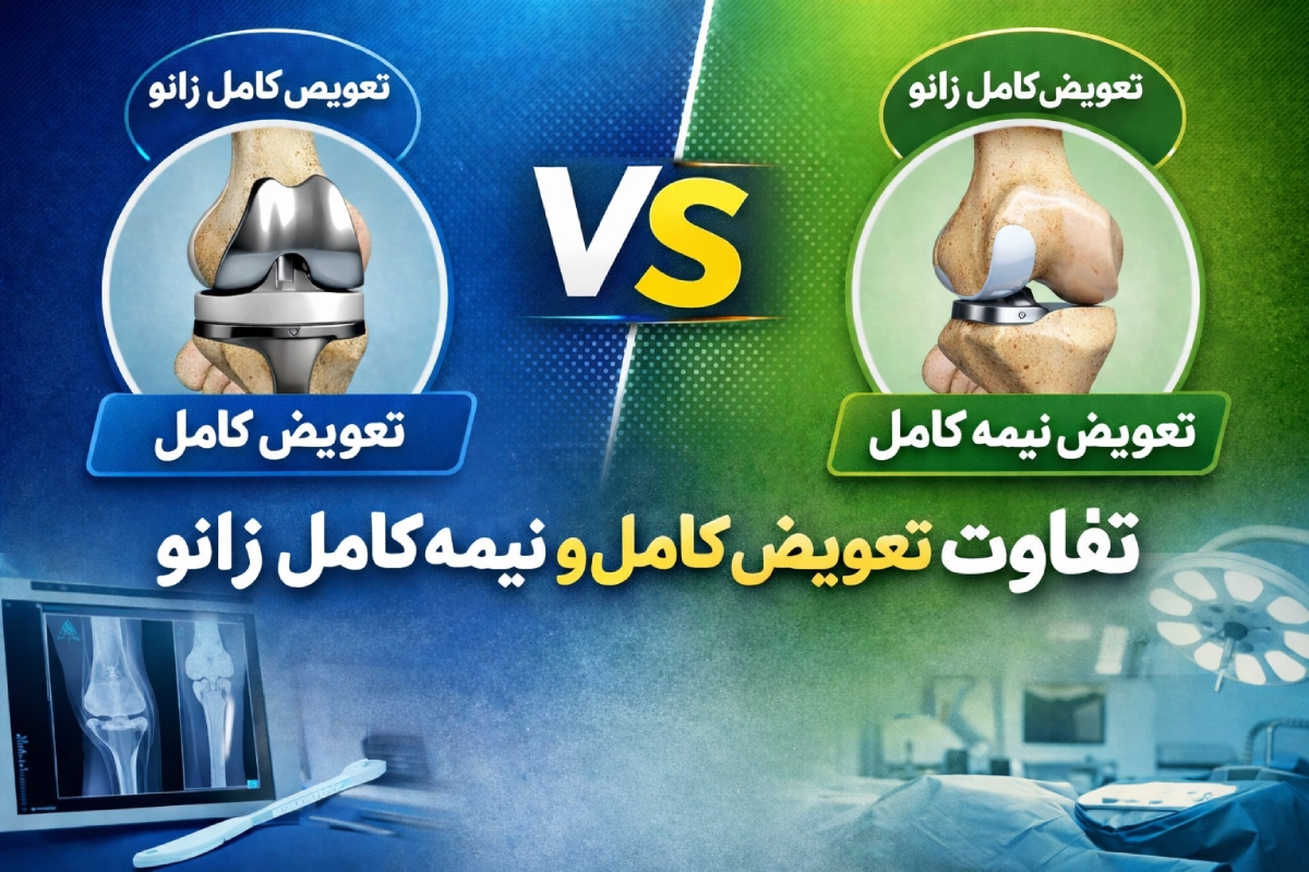 تفاوت تعویض کامل و نیمه‌کامل زانو