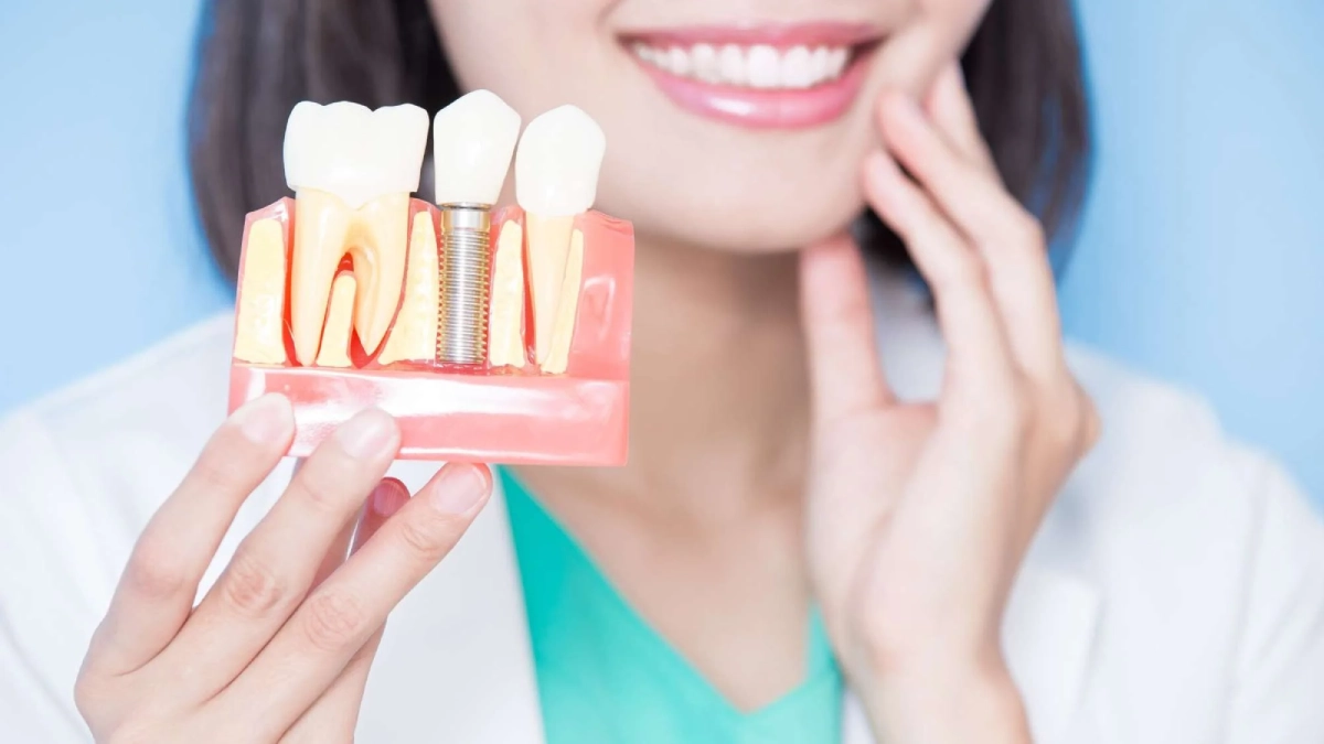 ایمپلنت دندان سوئدی در استانبول