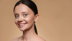 Deep Plane Facelift Surgery in Istanbul