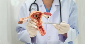 Anestezili HSG (ağrısız rahim filmi) nedir, nasıl yapılır ve kimlere uygulanır?