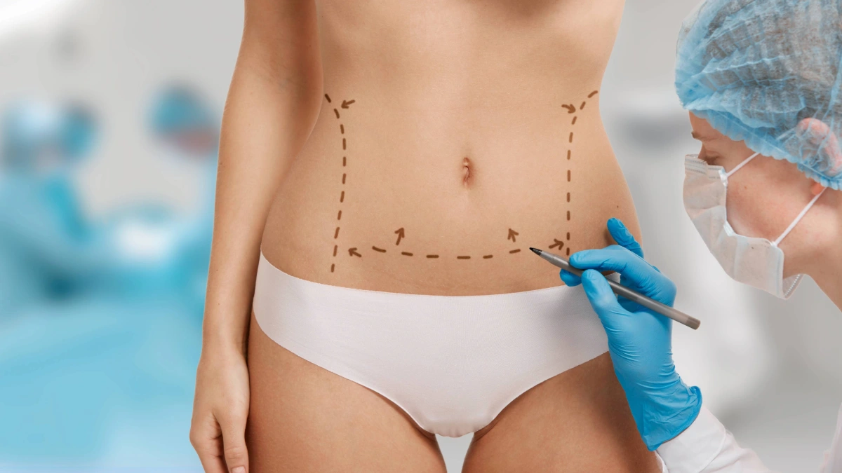 Tummy Tuck vs. Mini Tummy Tuck in Turkey