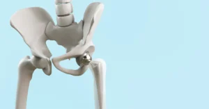 Advanced robotic surgery for hip replacement in Istanbul