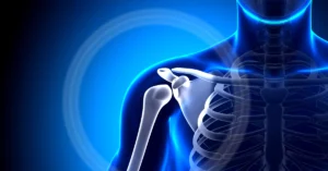 Shoulder arthroscopy surgery and recovery process in Turkey