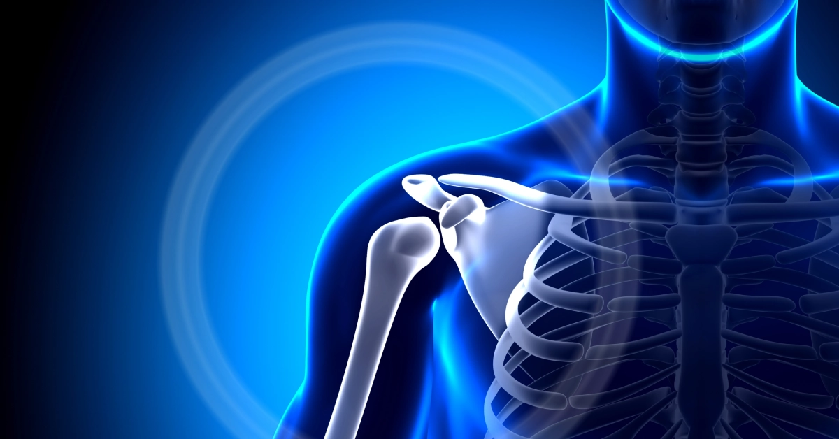 Shoulder arthroscopy surgery and recovery process in Turkey