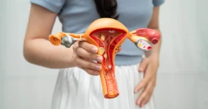 Comparing myomectomy and embolization for fibroid treatment.