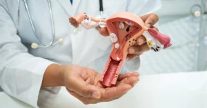 Non-surgical hysteroscopy treatment for uterine conditions.