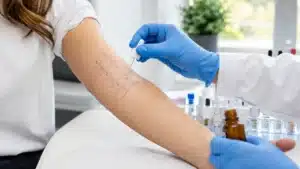 Allergy Testing in Turkey