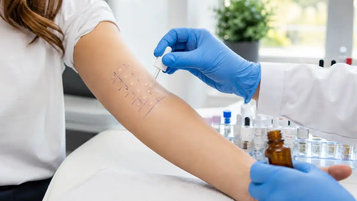 Allergy Testing in Turkey